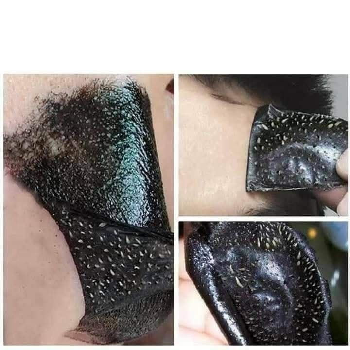 Lanbena Blackhead Remover Mask