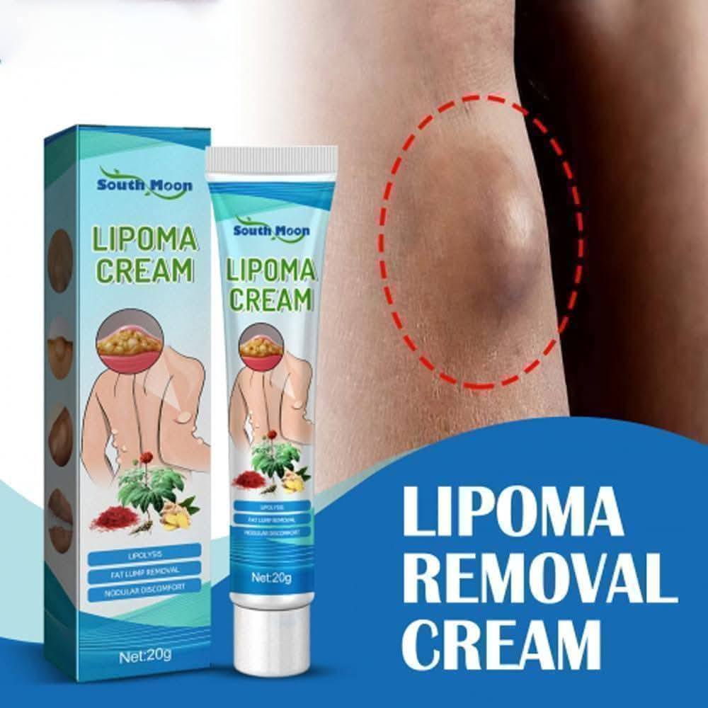 Lipoma Removal Cream