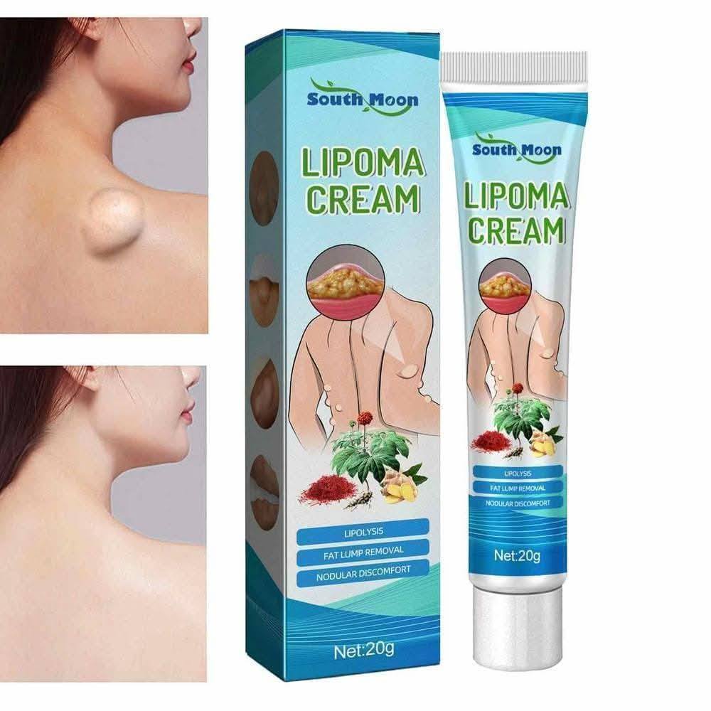 Lipoma Removal Cream