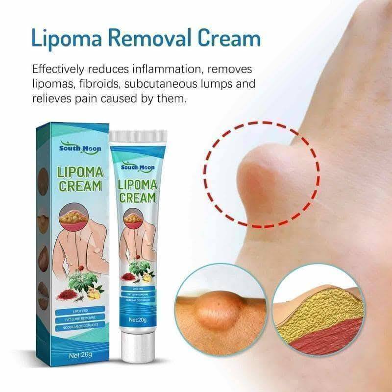 Lipoma Removal Cream