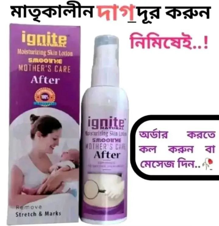 Ignite Mother Care Lotion(After)
