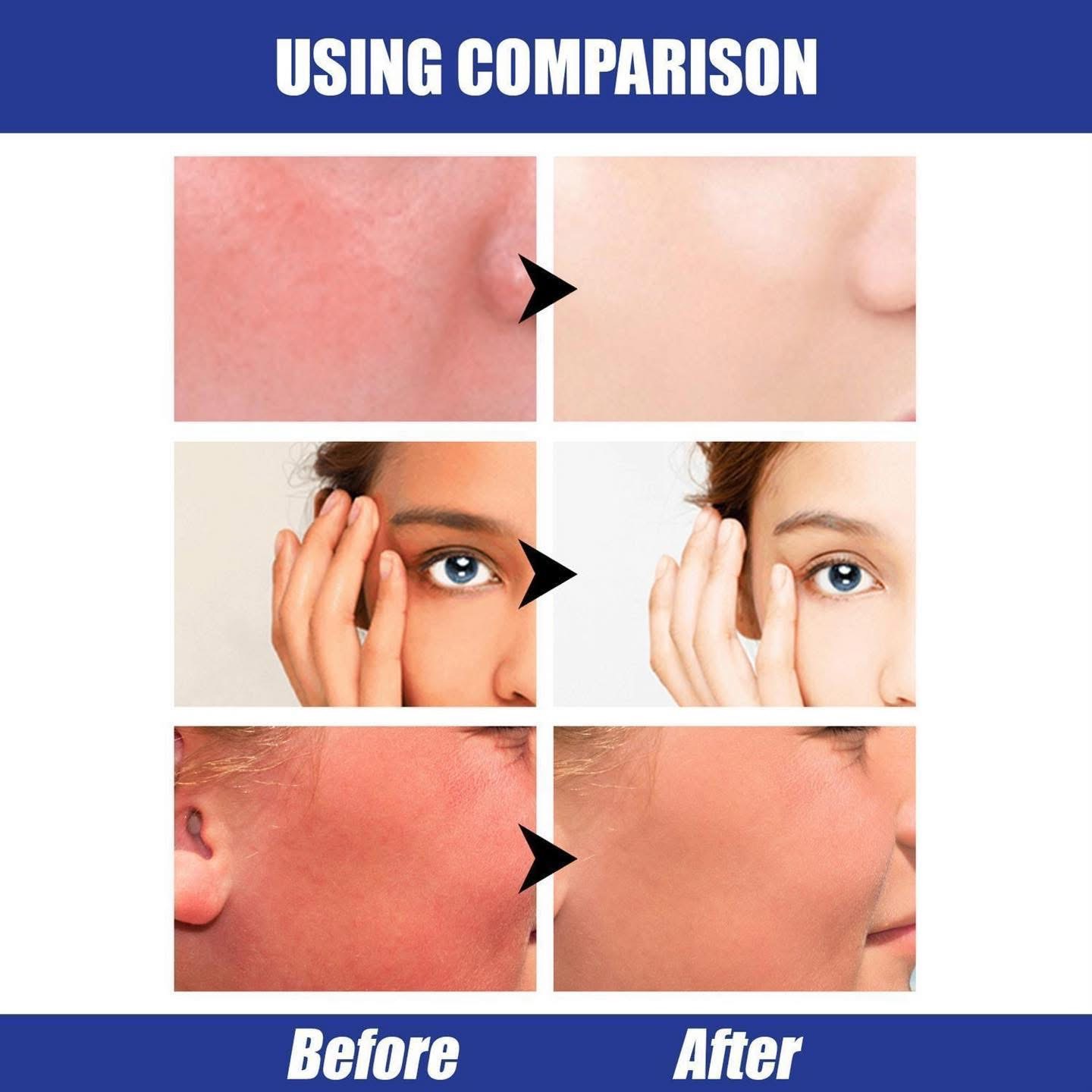 Hyaluronic Acid Airy Sun Stick – 22g