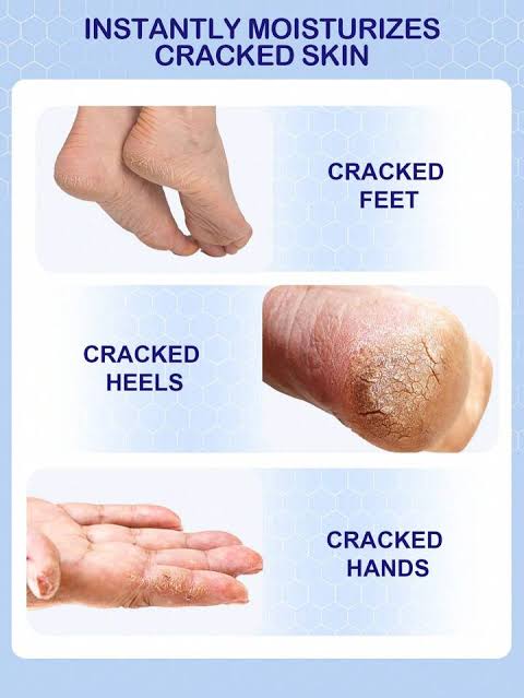 SlowSunday Salicylic Acid Moisturizing Foot Stick (1.05 oz./30 g) – Smooth & Renewed Feet