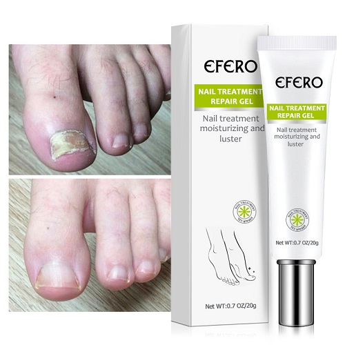 Efero Nail Repair Treatment Gel Fungus Cream-20gm